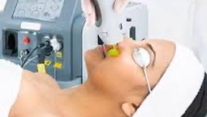 Laser Concept Epilation, Cryolipolyse et Peelings