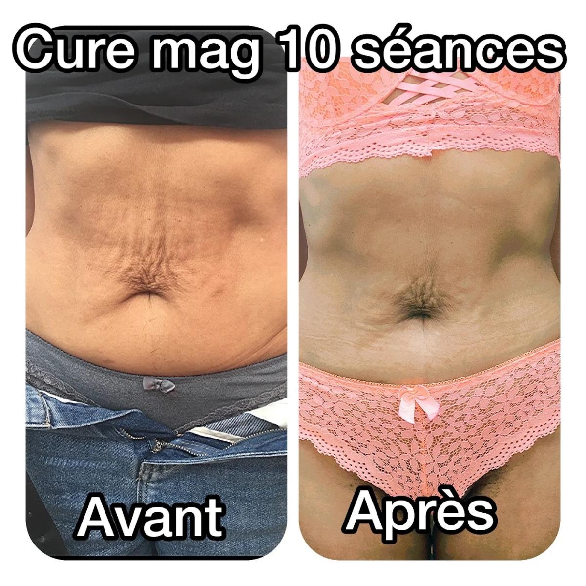 ESTHETIC CENTER EXPERT MINCEUR CHAMBLY