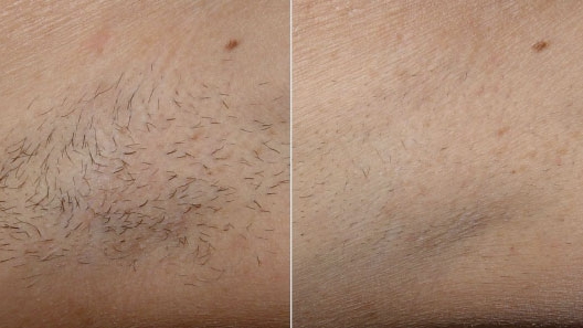 Institut M-A beauté Chatenoy Le Royal