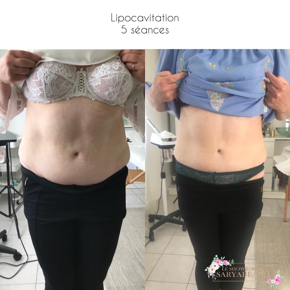 Le Showroom de SaryaBeauty