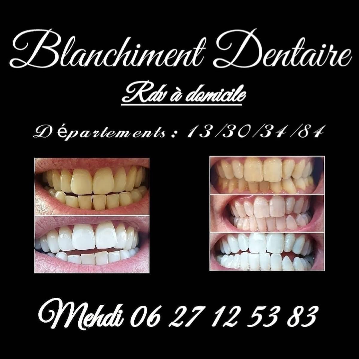 KM Blanchiment Dentaire