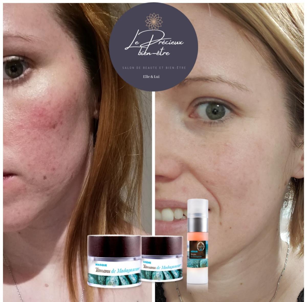 Le Précieux bien-être