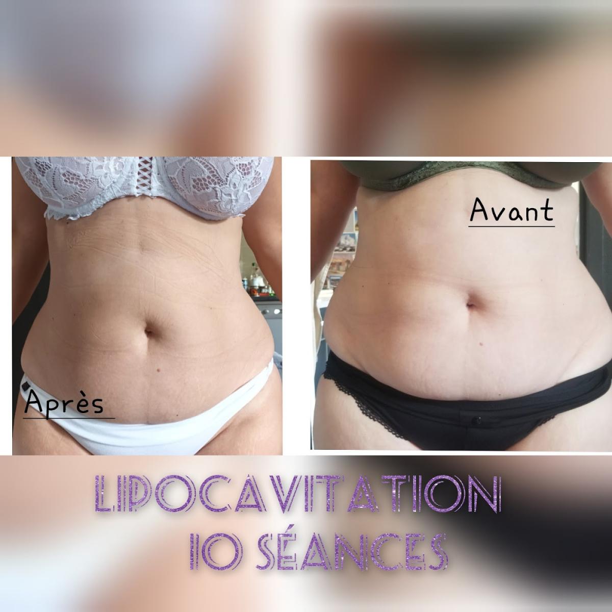 Marion Esthétique ( anciennement Allegria à Grenoble)