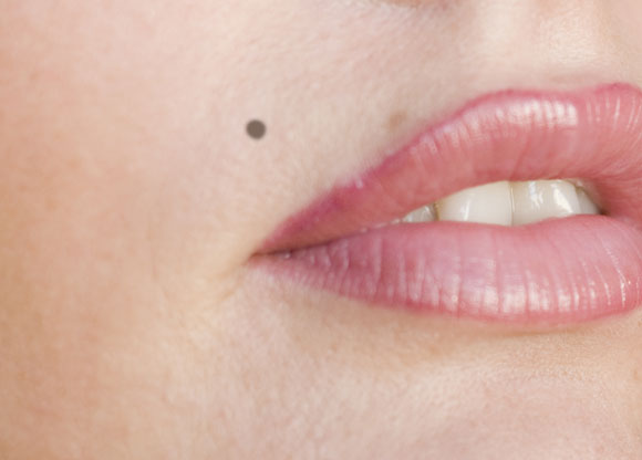 DERMAOZ: Maquillage semi permanent, dermographie, cryolipolyse et détatouage