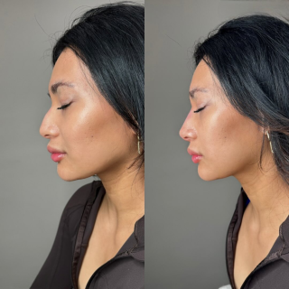 Salon de Manucure My Laser Lyon - Epilation Laser et Médecine Esthétique 0