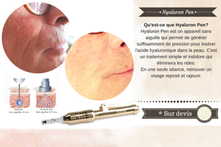 Salon de Manucure Kaméva Beauté - Institut de beauté Lisieux - Soins du visage 0