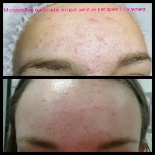 Salon de Manucure Chalet Stéphanie beauté *Esthétique *minceur *regard*lumière pulsée: épilation définitive *anti-âge 0