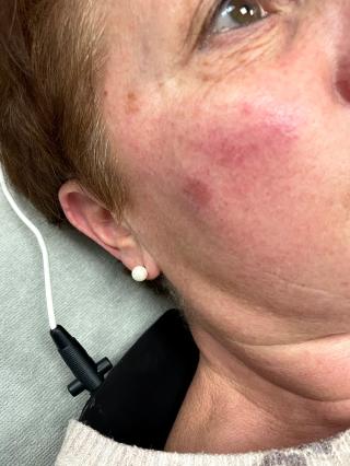 Salon de Manucure Institut de Beauté CENTRE KOEL ANGOULEME Centre Esthétique Expert Anti-Âge Minceur Epilation Definitive dont Laser 0