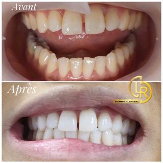 Salon de Manucure Dermo Center LR 0