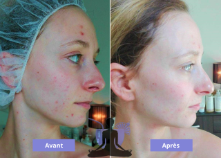 Salon de Manucure Cocktail de bien-être institut de beauté Seynod Annecy 0