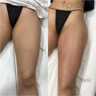 Salon de Manucure Rízia Medina Beauté 1