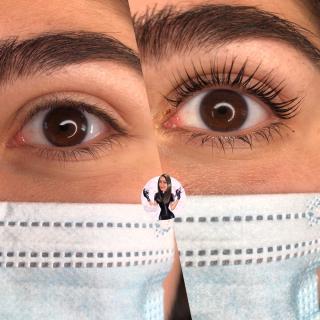 Salon de Manucure Perfect face microneedling 0