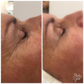 Salon de Manucure Centre Esthétique Avancée : Centre De Beauté A Lyon 0