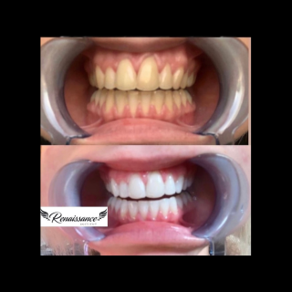 Salon de Manucure Renaissance institut 0