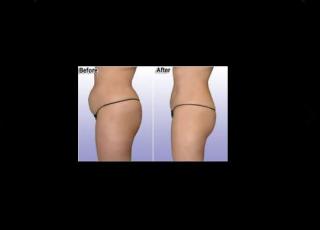 Salon de Manucure S.a.r.l Shape Cryo - Institut de beaute Venelles 1