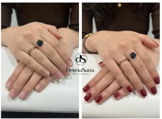 Salon de Manucure DermaSana ( L'île O' Sens ) 0